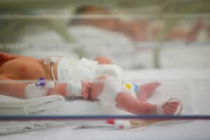Medical negligence can cause birth injuries